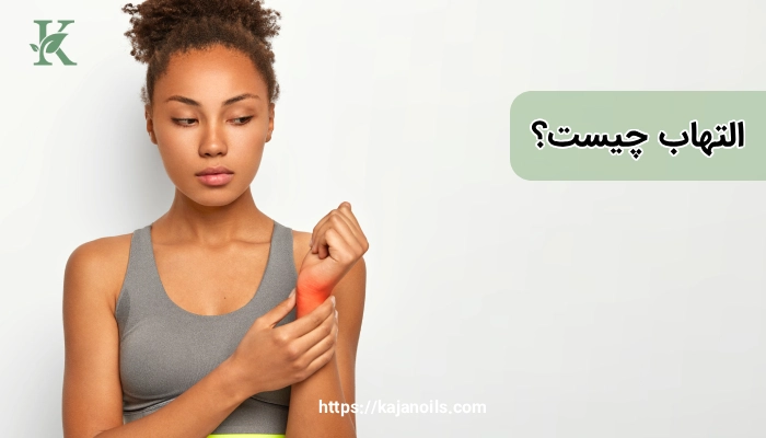 درمان طبیعی التهاب