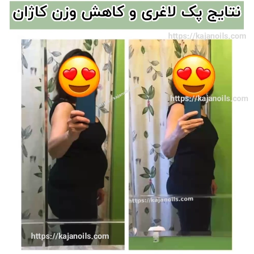 روش طب سنتی برای کاهش وزن