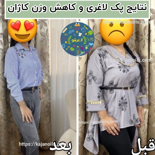 لاغری بدون رژیم