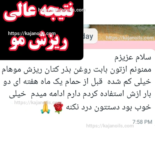 درمان طبیعی ریزش مو