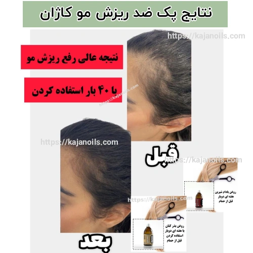 روغن گیاهی برای ریزش مو